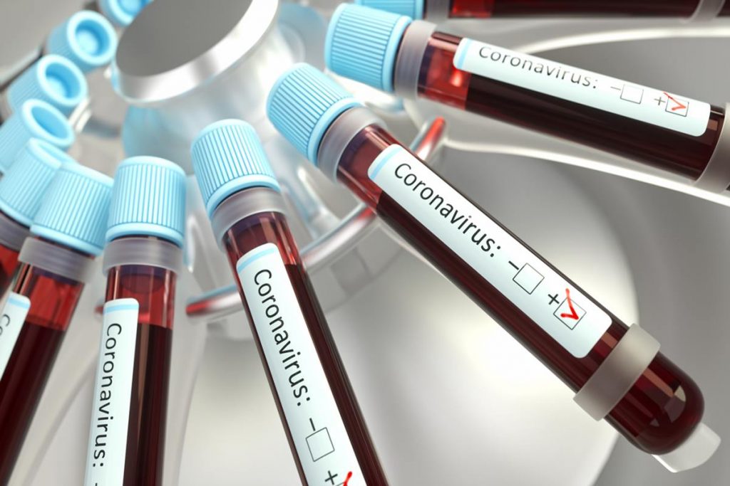 Coronavirus: ¿qué es la desinfodemia?