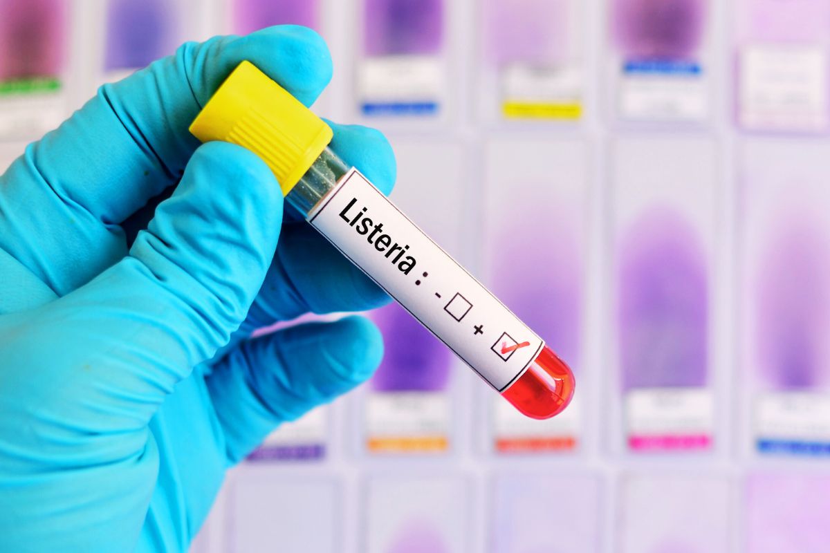 Listeriosis: qué es, transmisión y prevención