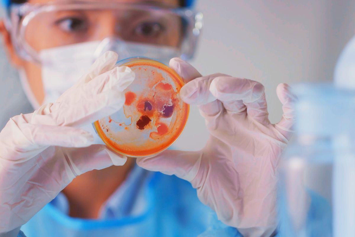 Criterios de aceptación microbiológica